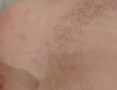 Masturbation