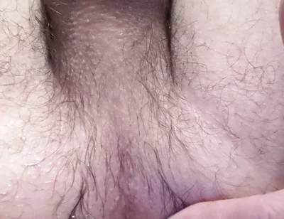 He Shoves a Potato up His Ass