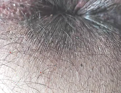 Face Farting POV HD