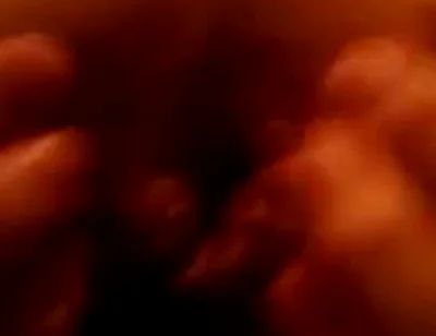 My First Anal Prolapse Video That I Shot