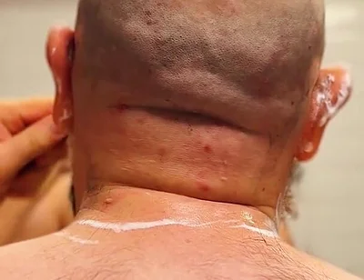 Shave Bald Head and Worship