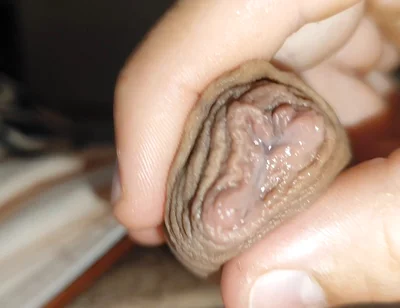 Silent Purge of Straight Scrotal Fluid.