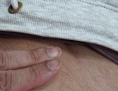 The Hair on My Penis - Led Hair Removal