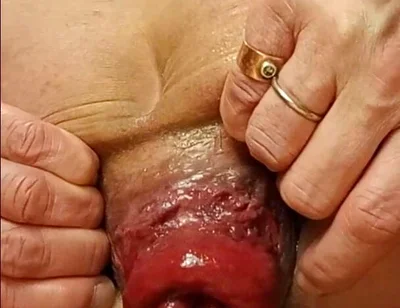 Live Anal Dilation Exercise on Cam to Make You Cum