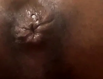 Talking About My Butt Hole