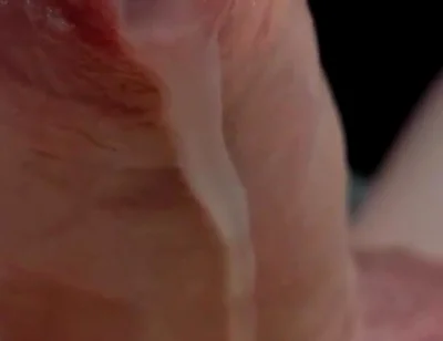 Phimosis Cock Leaking Cum Close-up Hands-free