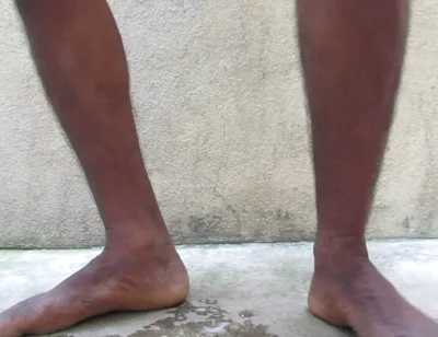 Mature Hairy Indian Cock Hair Removel After Oil Masturbation to Release Cum