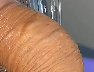 Mysterious Solution Inserted Into the Wrinkled Cock.