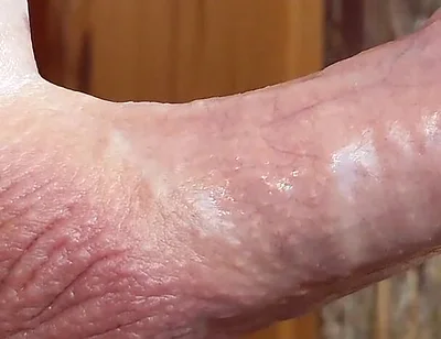 Small Hairless Virgin Phimosis Dick Braves the Cold for Some Hands-free Edging and Leaking Cum