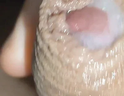 I Have the Largest Ejaculating Phimosis in the World!!