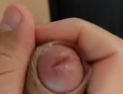 Amazing Pre Cum Glans.