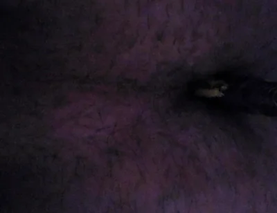 I'm Sticking a Razor Blade up My Ass.