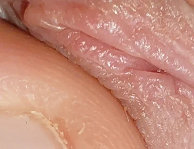 Enlargement of the Deep Urethral Hole!!