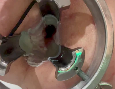 Pouring Hot Candle Wax Into Ass