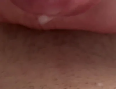 Sperm