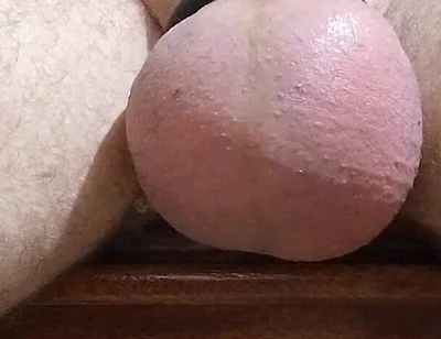 Saline and Masturbation