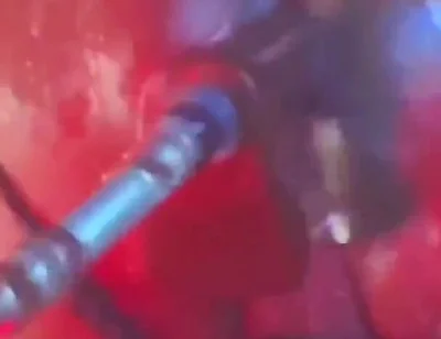 Intense Verbal Play Ahead...