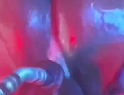 Intense Verbal Play Ahead...