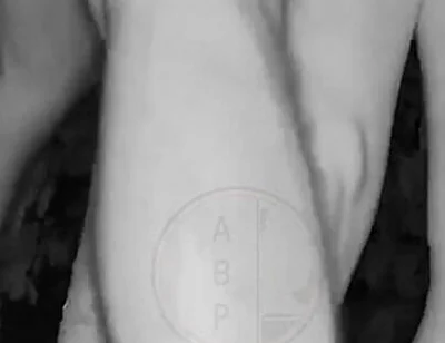 In a Park, at Night, Jules Is Desperate to Pee and Tries to Hide From His Friend but Is Caught on Night Vision Cam