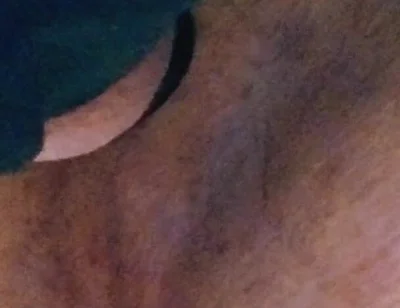 Park and Ride Breeding.