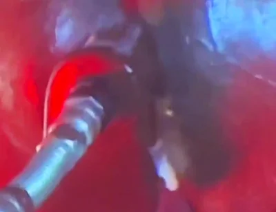 Intense Verbal Play Ahead...