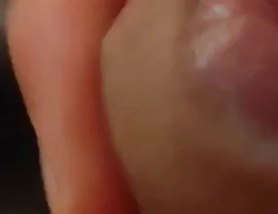 Great Phimosis Getting in the Way of the Boy's Orgasm