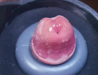 Penis Machine with a New Attachment