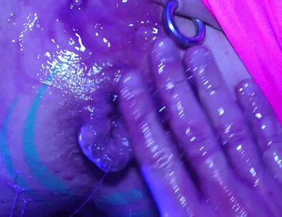 Axelabysse Very Berry