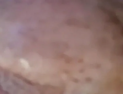 Extreme Fillings Inside My Siliconemeat