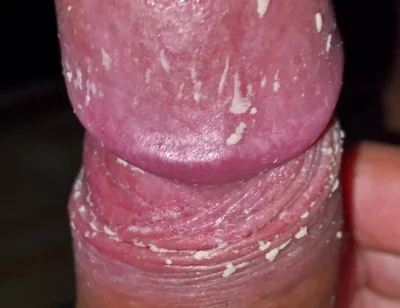 Checking My Dirty Dick