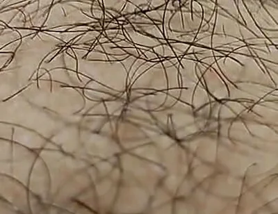 I'm Hairy Boy This My Legs and Dick