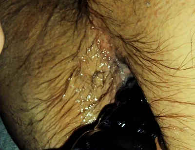 Training My Sloppy Hole