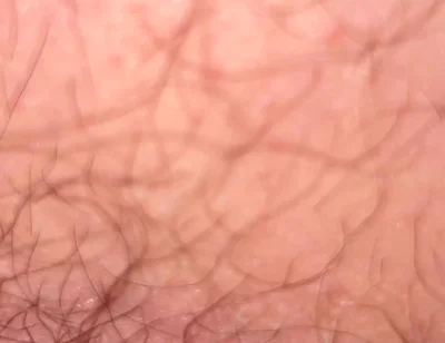 Close up Hairy Hole