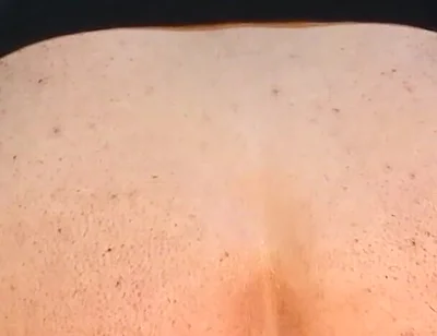 He Enjoys Sucking on His Anal Prolapse