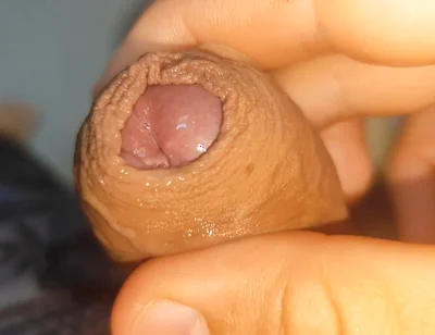 Its Source of Protein Is Already Dawning Like Rock