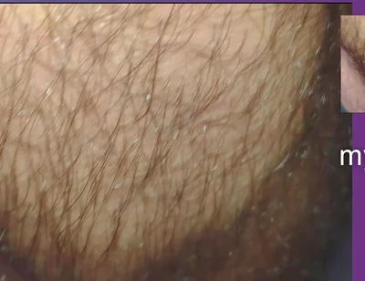 The Texture of the Clothes