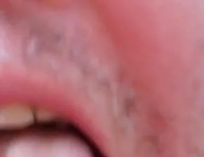 Camera Blunder in the Attempt at Facial Insemination