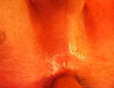 I Get Fucked by a Machine