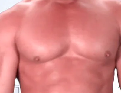 Be My Dental Patient and Pretend to Be Kyle