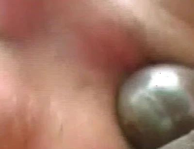 Gaping Anal Rosebud Prolapsing After Deep Stretching Session