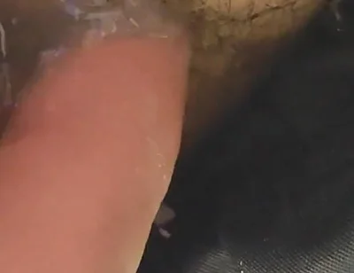 Uncircumcised Phimosis Has the First Ejaculation.