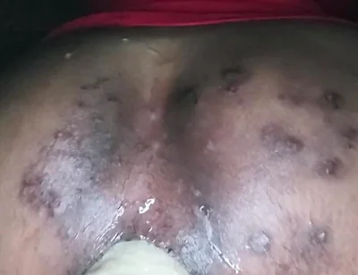 Up and Personal with the Thrashy Ass of a CD