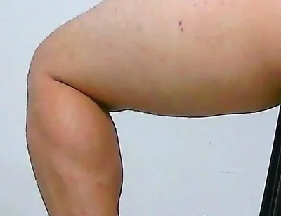 Oh, My Ass Hurts, Apply Ointment