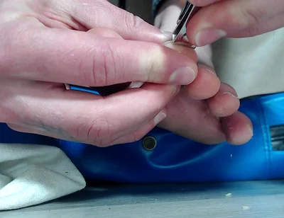 My Feet Stink and My Nails