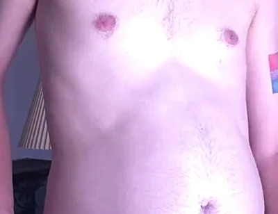 Young Mans Belly Turns Into a Orb