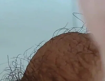 Extreme Open Hole Leaves the Glans Exposed.