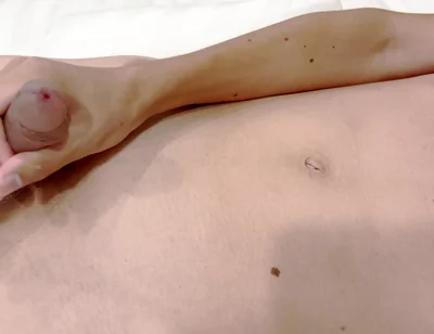 A Boy with a Large Foreskin Gets an Erection, Masturbates, and Cums Twice