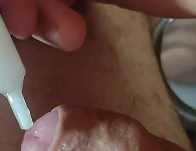 Reuse of Cum Through the Urethral Canal.