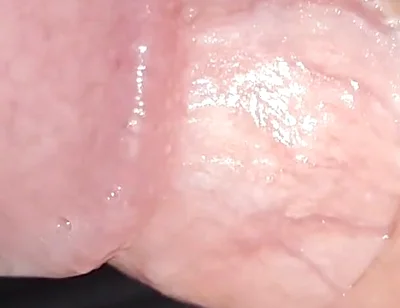 Incredible Cock, Unique of Slippery Phimosis by the Robust Body.