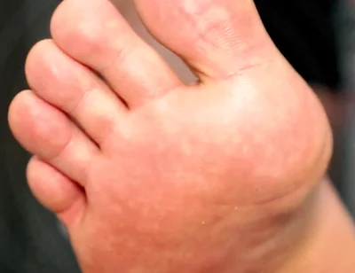 Golden Foot Bath for Pigs